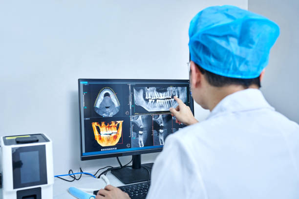 Best Emergency Wisdom Teeth Removal in Williston, SC